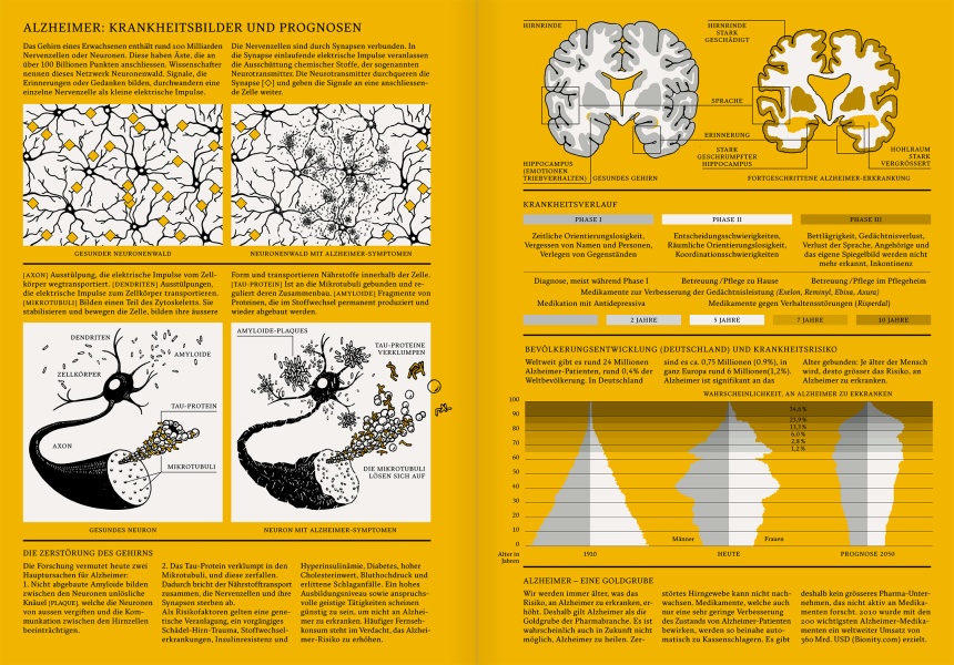 Reportagen #09 Infographic Alzheimer